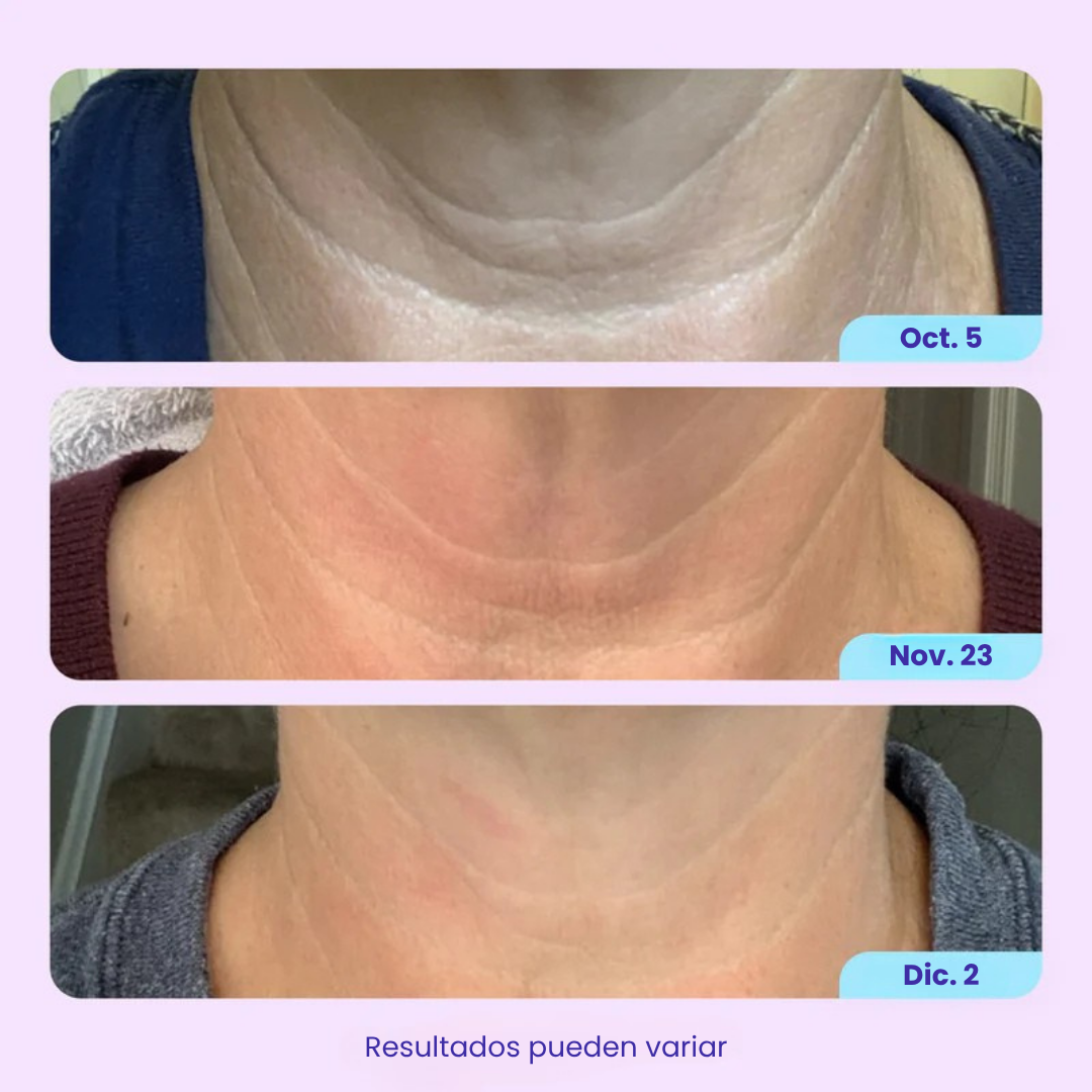 Vitalenz™ - Crema Reafirmante de Cuello y Escote
