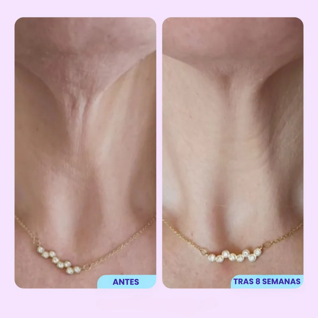 Vitalenz™ - Crema Reafirmante de Cuello y Escote
