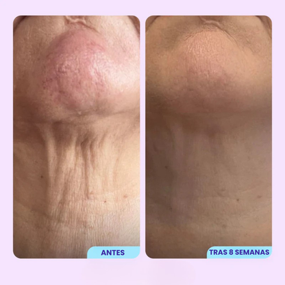 Vitalenz™ - Crema Reafirmante de Cuello y Escote